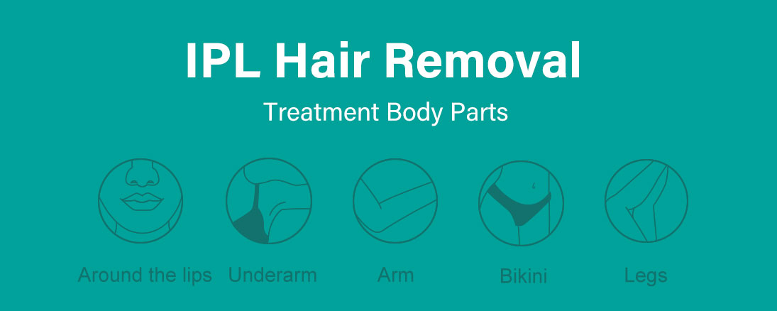at-home laser hair removal for face
