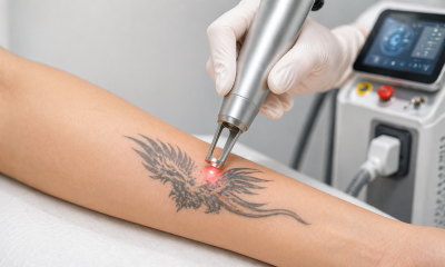 Can a Diode Laser Remove Tattoos? The Complete Guide for Aesthetic Clinics Can a Diode Laser Remove Tattoos? The Complete Guide for Aesthetic Clinics